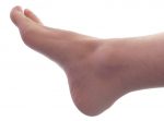 Photo of a foot.